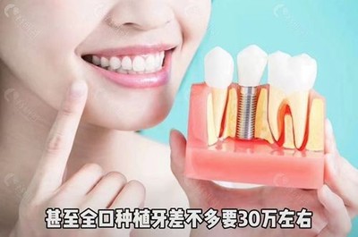 种牙什么时候进医保