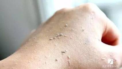 角质是什么东西