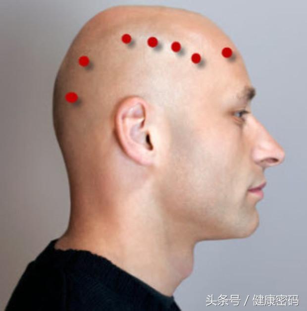 额头按摩非常酸疼是什么原因