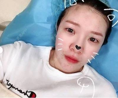 夏天混油用什么隔离