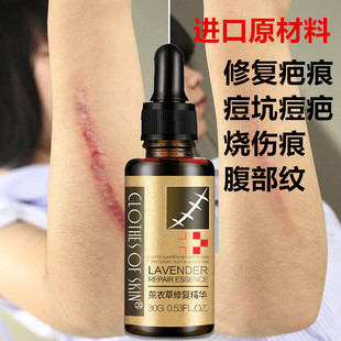 疤痕修复精华是什么意思