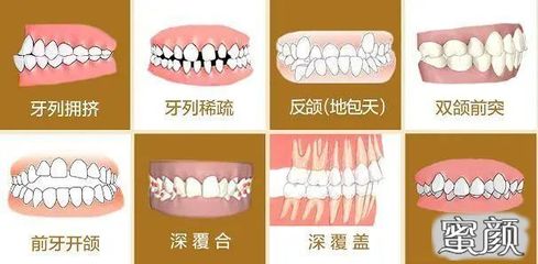 为什么牙齿会变稀疏
