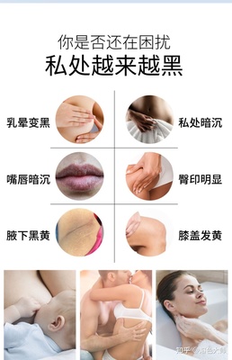 去黑色素的方法有哪些 退黑色素的方法有哪些