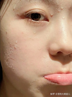 脸上有滑滑的是什么