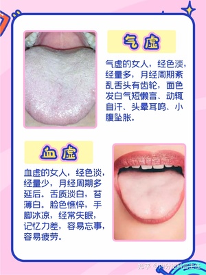 为什么经期期间脸色差