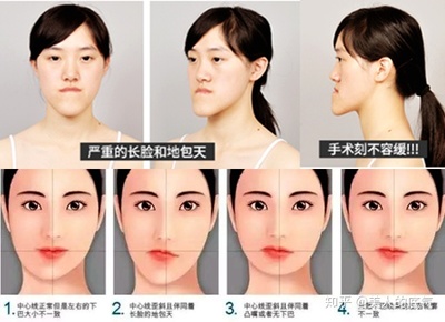 为什么嘴唇凸