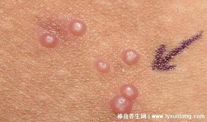皮肤像蜡一样的东西是什么意思