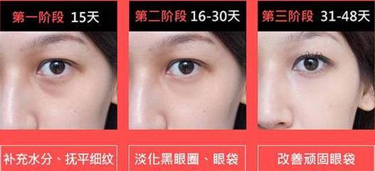 眼部为什么会出现细纹