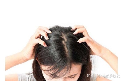 女生掉头发因为什么原因