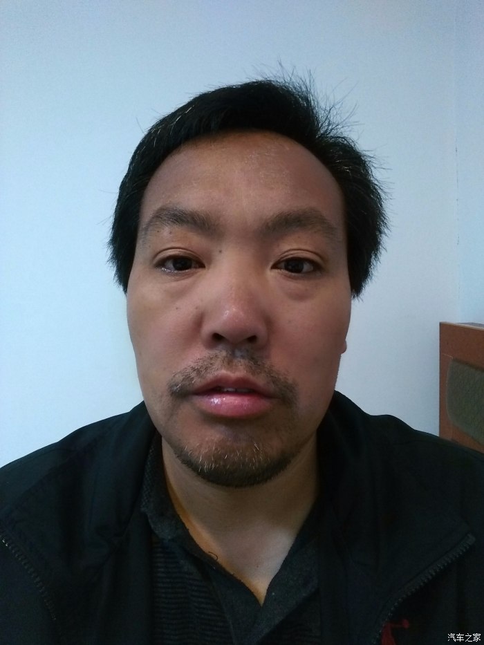 鼻子起皮什么原因