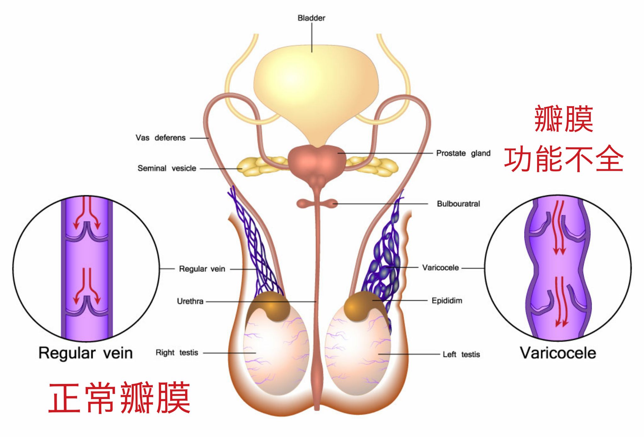瓣膜是什么样的