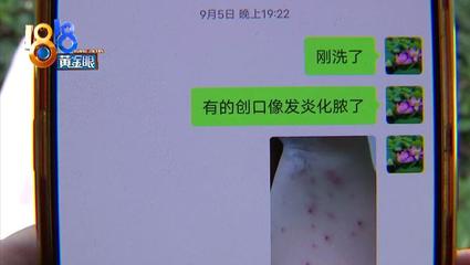 点痣吃什么药