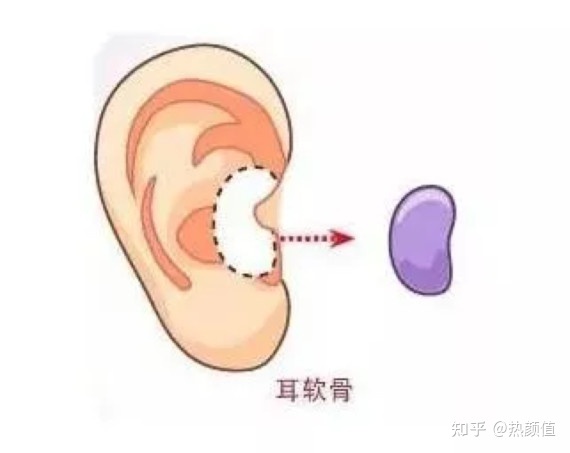 什么夹鼻子