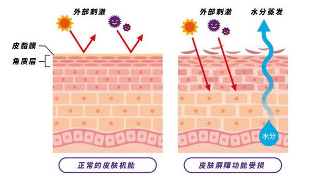 为什么皮肤却水