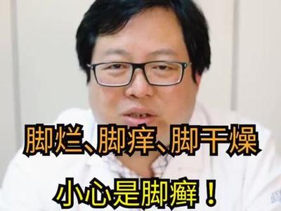 脚干燥掉皮用什么药膏