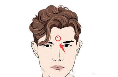 男人额头大说明什么原因是什么原因