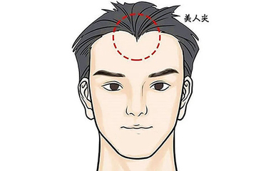 男人额头大说明什么原因是什么原因